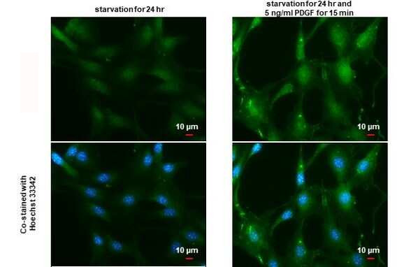 Phospho-AKT1 (Ser473) Antibody in Immunocytochemistry (ICC/IF)