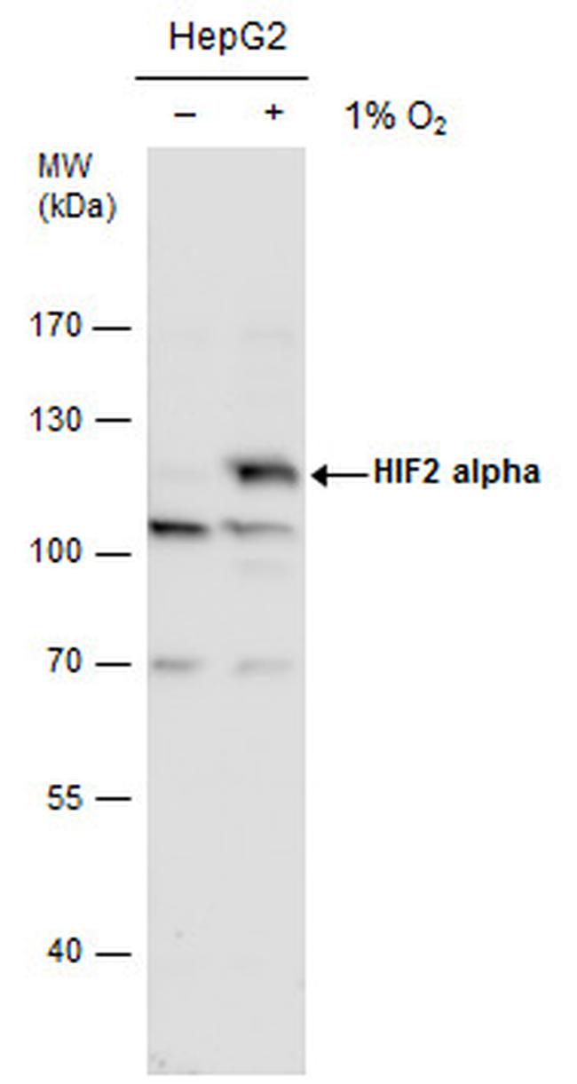 HIF-2 alpha Antibody in Western Blot (WB)