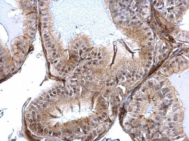 SLUG Antibody in Immunohistochemistry (Paraffin) (IHC (P))