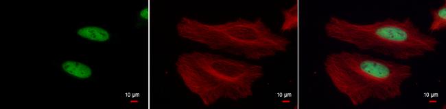 H3K4me3 Antibody in Immunocytochemistry (ICC/IF)