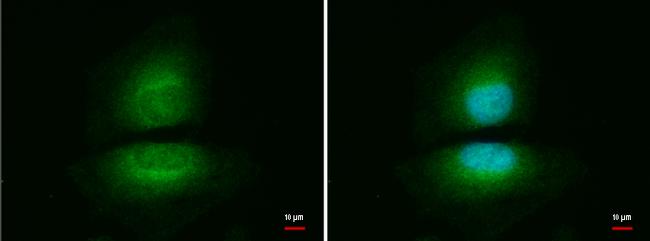 NAMPT Antibody in Immunocytochemistry (ICC/IF)