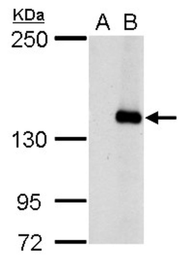 JARID2 Antibody in Western Blot (WB)