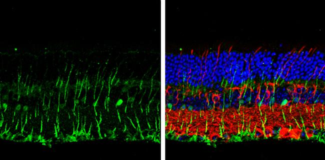 DLX2 Antibody in Immunohistochemistry (Paraffin) (IHC (P))