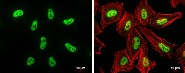 DNMT3B Antibody in Immunocytochemistry (ICC/IF)