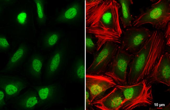 SIN3A Antibody in Immunocytochemistry (ICC/IF)