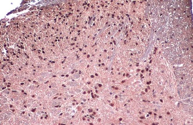 FOXP1 Antibody in Immunohistochemistry (Paraffin) (IHC (P))