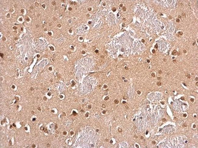 UBC9 Antibody in Immunohistochemistry (Paraffin) (IHC (P))