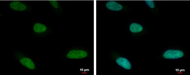 ARID1A Antibody in Immunocytochemistry (ICC/IF)