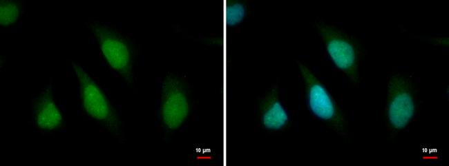 ARID2 Antibody in Immunocytochemistry (ICC/IF)