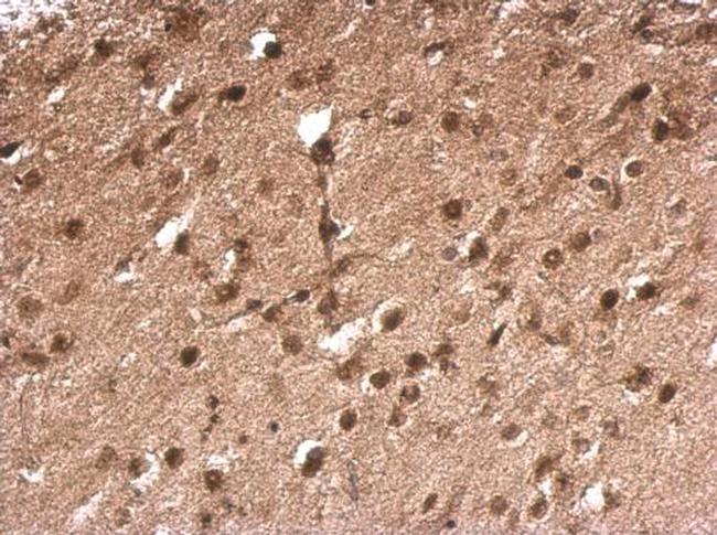 TLX3 Antibody in Immunohistochemistry (Paraffin) (IHC (P))