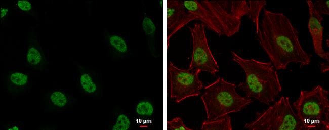 H3K27me3 Antibody in Immunocytochemistry (ICC/IF)