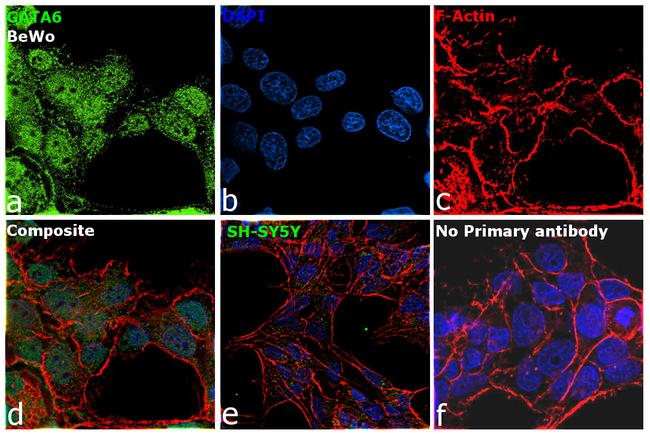 GATA6 Antibody in Immunocytochemistry (ICC/IF)