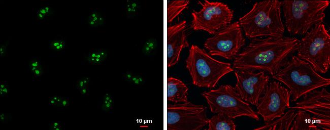 p14ARF Antibody in Immunocytochemistry (ICC/IF)