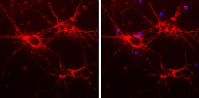 alpha Internexin Antibody in Immunocytochemistry (ICC/IF)