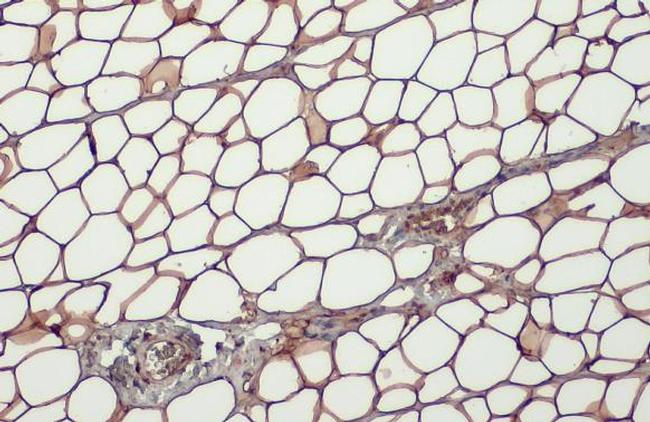 Perilipin 1 Antibody in Immunohistochemistry (Paraffin) (IHC (P))