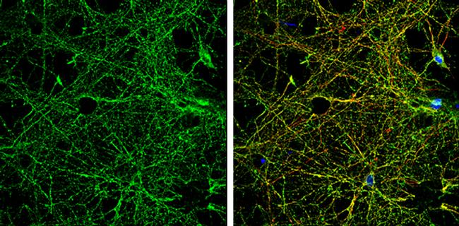 NMDAR2B Antibody in Immunocytochemistry (ICC/IF)