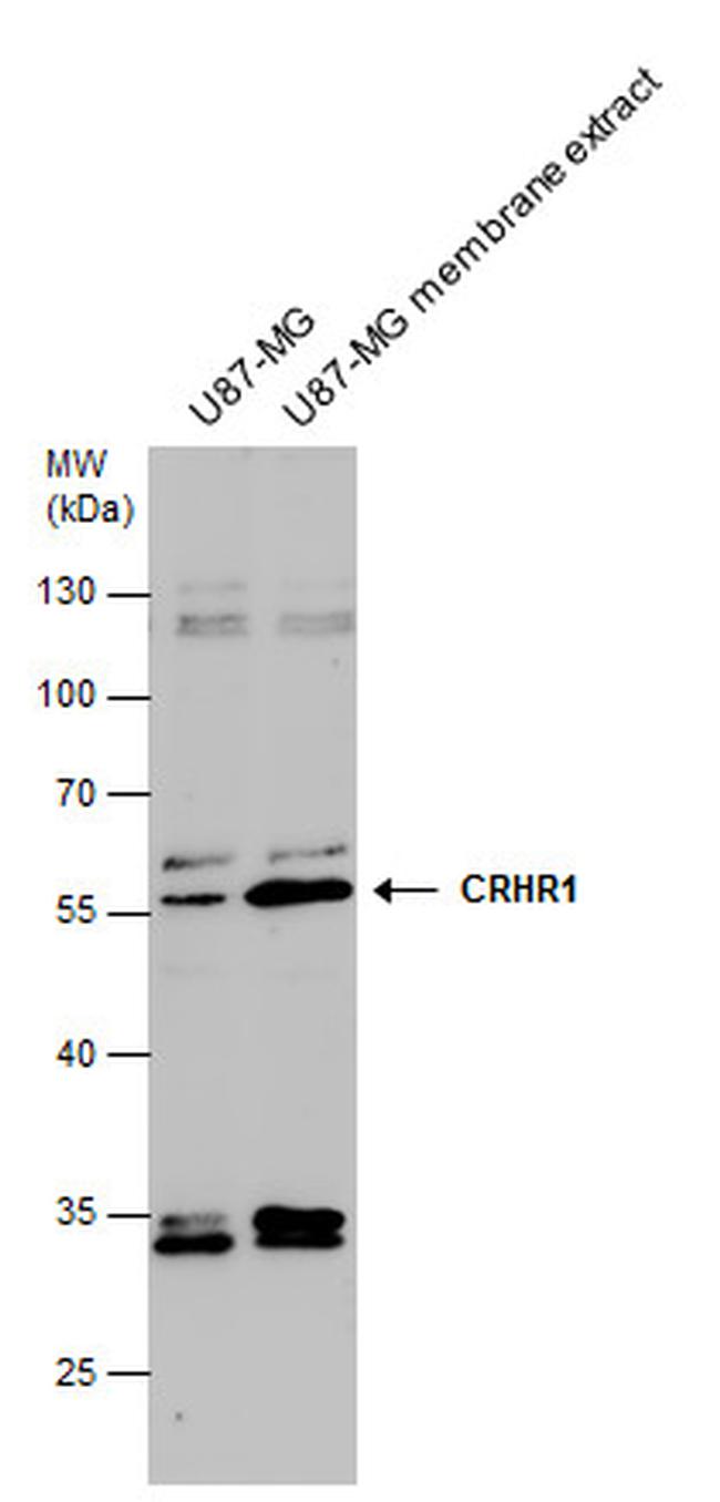 CRHR1 Antibody in Western Blot (WB)