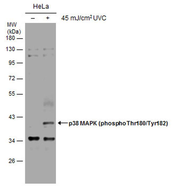 Phospho-p38 MAPK (Thr180, Tyr182) Antibody in Western Blot (WB)