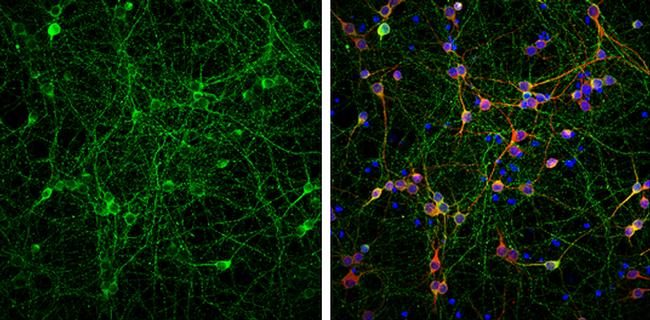 Phospho-Tau (Ser262) Antibody in Immunocytochemistry (ICC/IF)