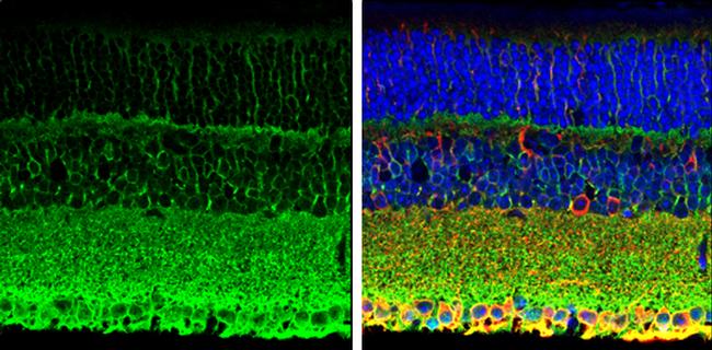 PMCA1 ATPase Antibody in Immunohistochemistry (Paraffin) (IHC (P))