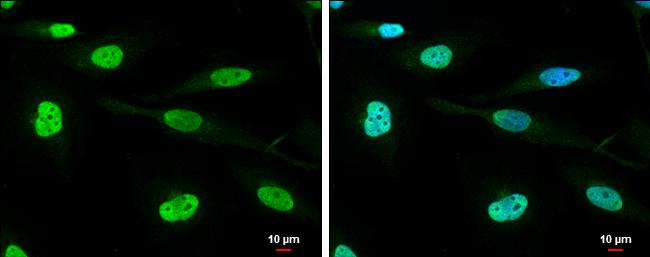 DHX9 Antibody in Immunocytochemistry (ICC/IF)