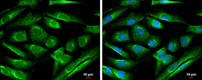 ATL1 Antibody in Immunocytochemistry (ICC/IF)