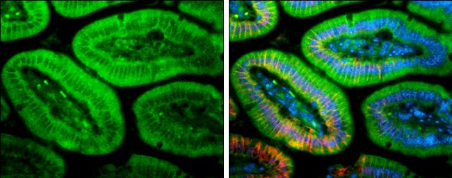 PLEKHA7 Antibody in Immunohistochemistry (Paraffin) (IHC (P))