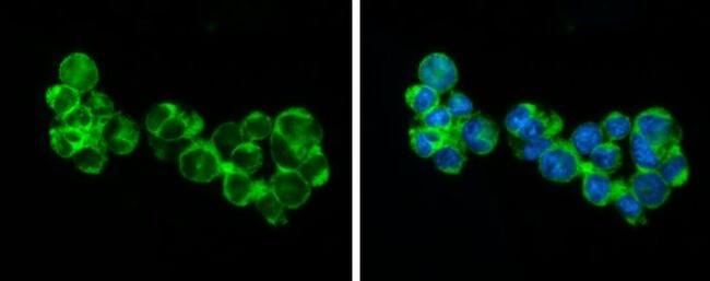 RIP3 Antibody in Immunocytochemistry (ICC/IF)