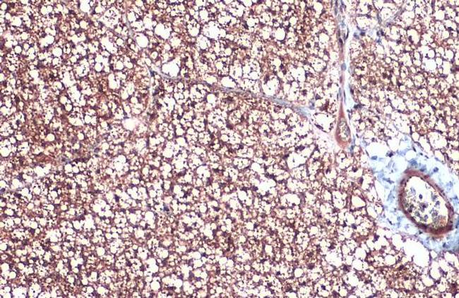 UCP1 Antibody in Immunohistochemistry (Paraffin) (IHC (P))