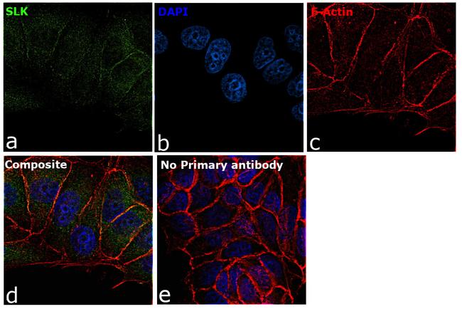 SLK Antibody in Immunocytochemistry (ICC/IF)