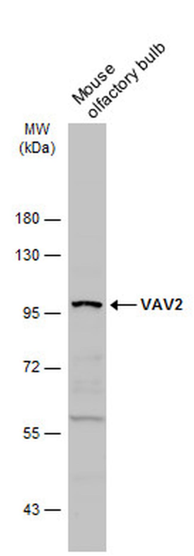 VAV2 Antibody in Western Blot (WB)