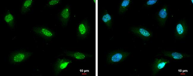 SP100 Antibody in Immunocytochemistry (ICC/IF)