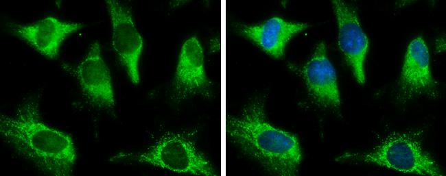 Pyruvate Carboxylase Antibody in Immunocytochemistry (ICC/IF)