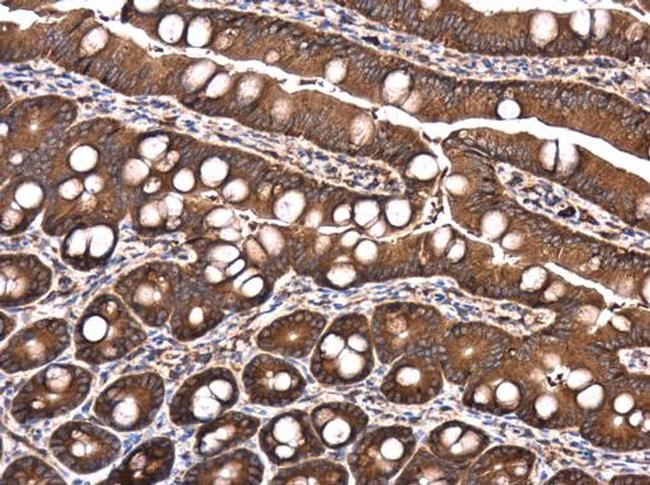 Raptor Antibody in Immunohistochemistry (Paraffin) (IHC (P))