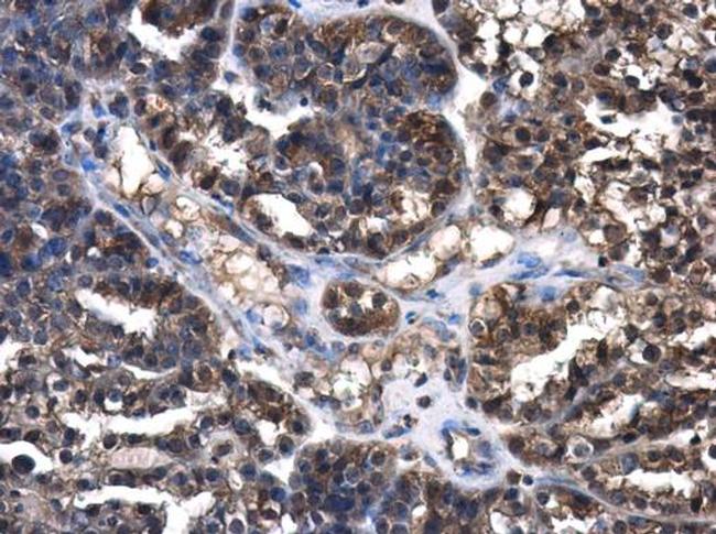 Cystatin C Antibody in Immunohistochemistry (Paraffin) (IHC (P))