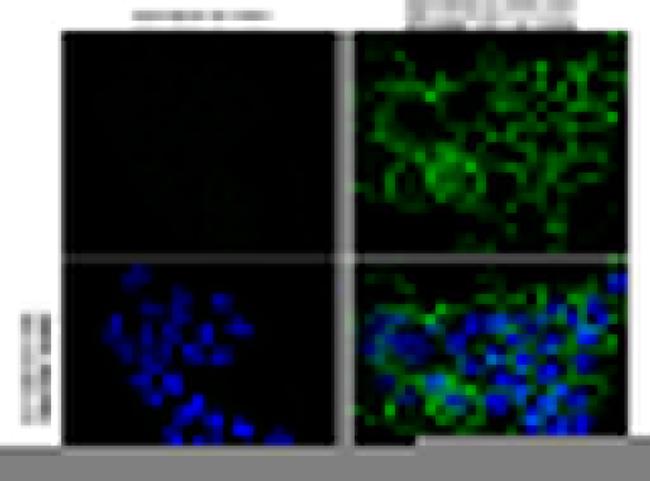 Phospho-EGFR (Tyr1068) Antibody in Immunocytochemistry (ICC/IF)