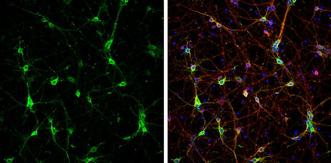 CaMKII beta Antibody in Immunocytochemistry (ICC/IF)