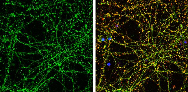 SLC6A4 Antibody in Immunocytochemistry (ICC/IF)