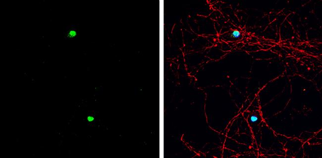 ASCL1 Antibody in Immunocytochemistry (ICC/IF)