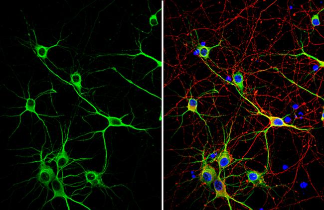 MAP2 Antibody in Immunocytochemistry (ICC/IF)