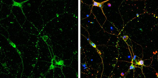 SHANK3 Antibody in Immunocytochemistry (ICC/IF)