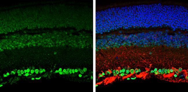 OTX2 Antibody in Immunohistochemistry (Paraffin) (IHC (P))