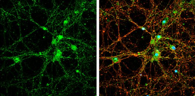 PSD93 Antibody in Immunocytochemistry (ICC/IF)