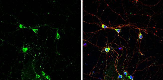 PSD93 Antibody in Immunocytochemistry (ICC/IF)