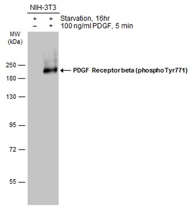 Phospho-PDGFRB (Tyr771) Antibody in Western Blot (WB)