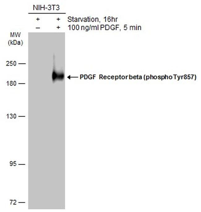 Phospho-PDGFRB (Tyr857) Antibody in Western Blot (WB)