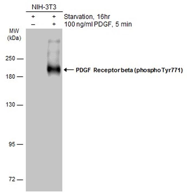 Phospho-PDGFRB (Tyr771) Antibody in Western Blot (WB)