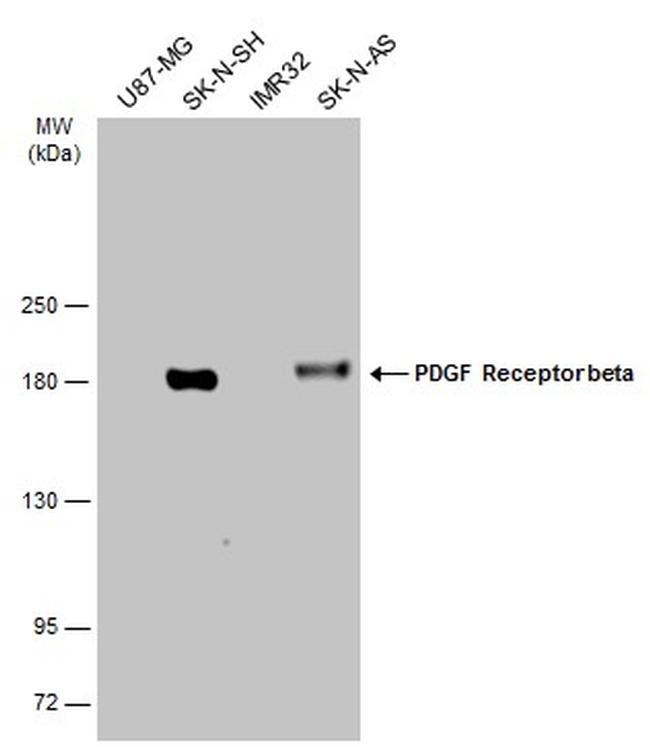 PDGFRB Antibody in Western Blot (WB)