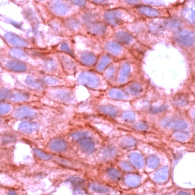 ErbB4 Antibody in Immunohistochemistry (Paraffin) (IHC (P))