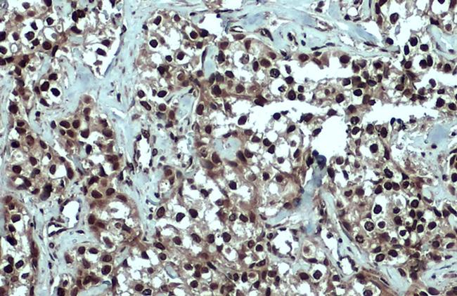 53BP1 Antibody in Immunohistochemistry (Paraffin) (IHC (P))